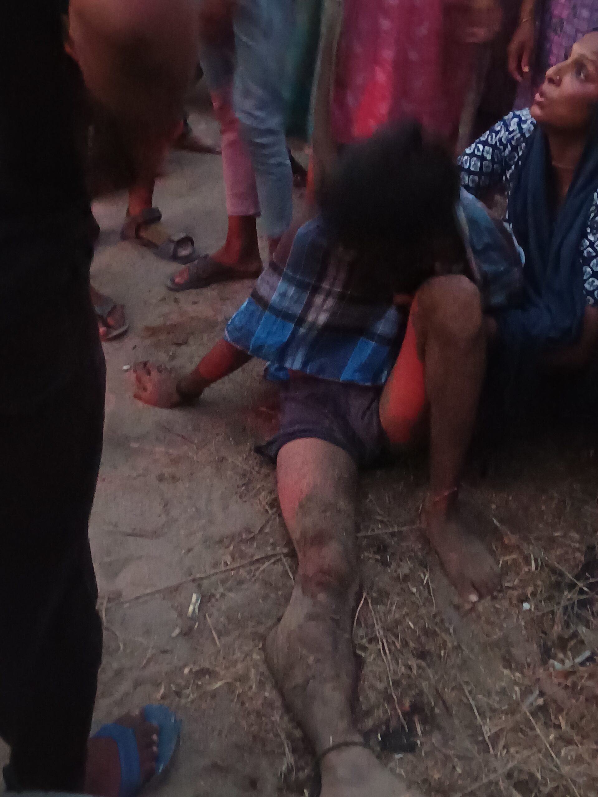 ट्रक-बाइक की टक्कर से युवक घायल हालत गंभीर